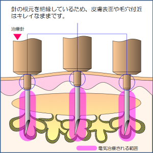 グラフィックス2