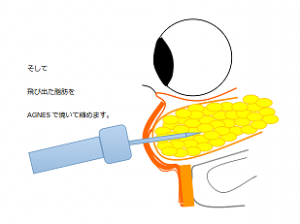 スクリーンショット (12)