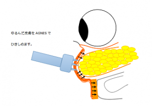 スクリーンショット (13)